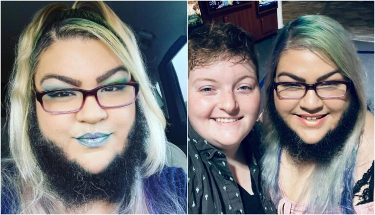 Ponosna na svoju bradu: “Otkad sam prestala s brijanjem postala sam sretnija, momak me podržava”