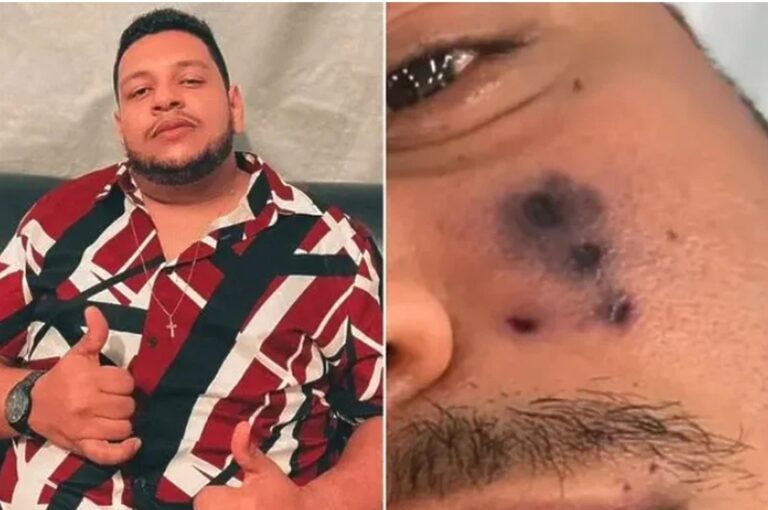 Popularni brazilski pjevač preminuo nakon ugriza pauka: Lice mu je počelo mijenjati boju