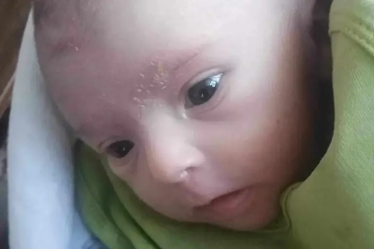 BUDIMO HUMANI: Pomozimo zajedno bebi Dženanu, rođen je bez nepca