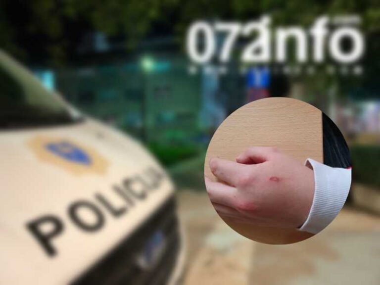 NASILJE U ŠKOLI U VISOKOM: Dječak sa posebnim potrebama spržen cigaretom 