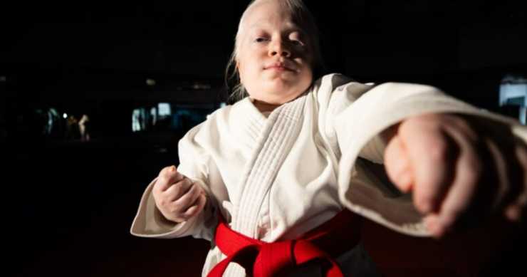 Albino djevojčica (15) niže uspjehe uprkos zdravstvenim problemima: Bejza ne odustaje od svoje VELIKE ŽELJE