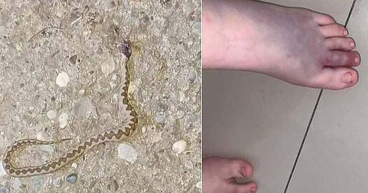 Na granici BiH i Hrvatske: Ženu ugrizao poskok dok je brala mladi luk, hitno prebačena u bolnicu