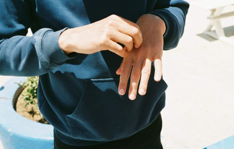 KOŽA VAS SVRBI, A RUKE I NOGE TRNU? Simptomi bolesti od koje boluje desetine hiljada ljudi u BiH