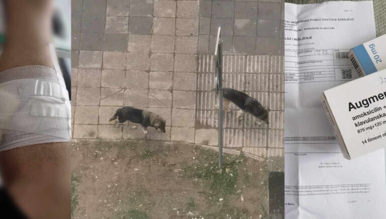 ŽALOSNO | Čovjeka ujeo pas pa završio u hitnoj: “Cuko je mjesecima tu, svi ga hrane”