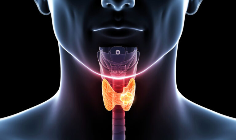 Ljekar upozorio na rak “u porastu”, ima simptome koje je lako promaći