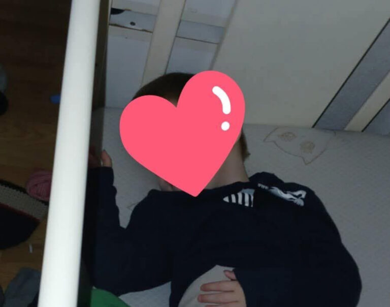 Pomozimo malom Sedinu Aliću: Potrebna sredstva za liječenje u Turskoj