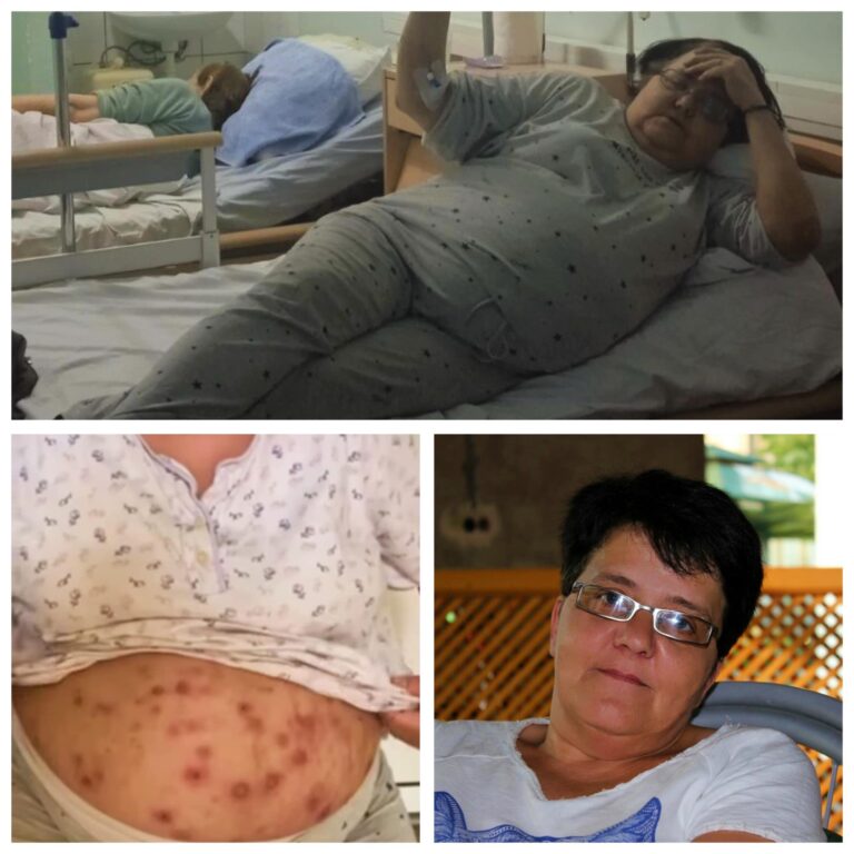 Apel za pomoć: Samohrana majka i demobilisani borac sva u živim rana