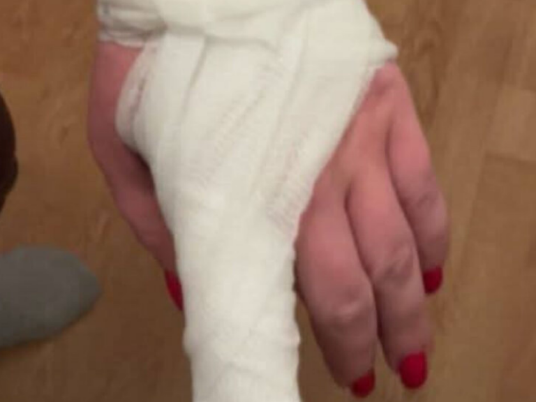 UŽAS U BIH: Amar sa ocem i amidžom pretukao suprugu pred djecom