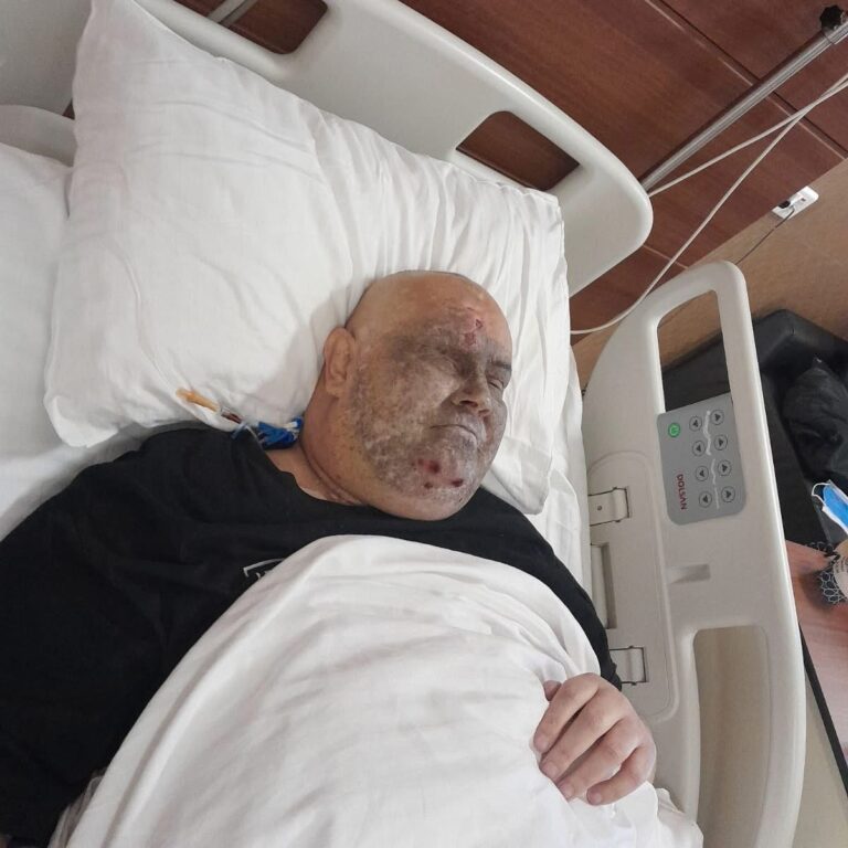 Za Šimuna prikupljeno 148.985 KM, potrebno još 24.500 KM