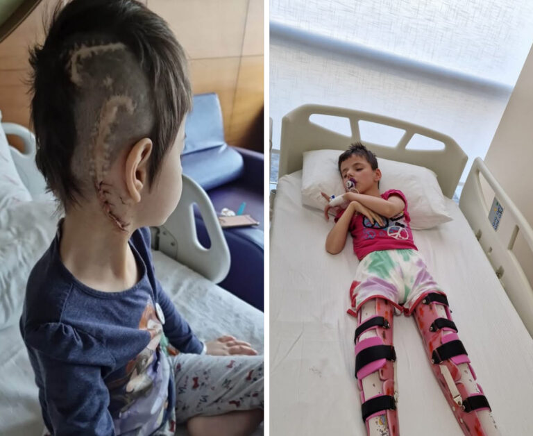 IZA MEDINE JE 31 OPERACIJA NA MOZGU: Hitno potrebno 25.000 eura za novu operaciju