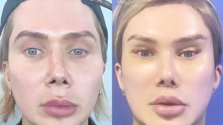 Britanac potrošio 600.000 eura da postane žena: Sada želi opet biti muškarac