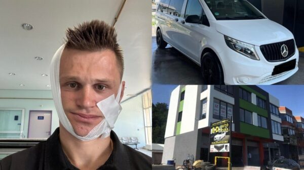 Ammaru slomljena vilica na oba dijela nakon fizičkog napada u automehaničarskoj radionici