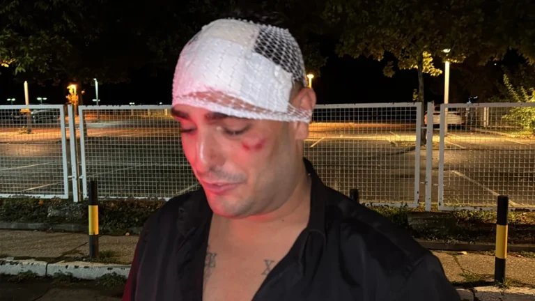 Je li vozio pijan i drogiran? Pojavile se prve fotografije Darka Lazića nakon teške saobraćajne nesreće