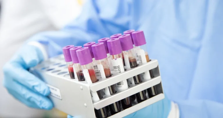 Samo 50 ljudi na svijetu ima “zlatnu krv”, naučnici pokušavaju da ih kloniraju