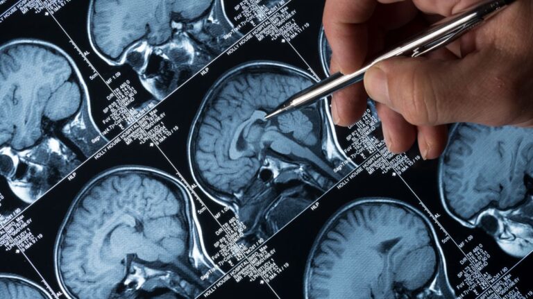 Naučnici testiraju kapi za nos koje izravno napadaju jedan od najopakijih tumora