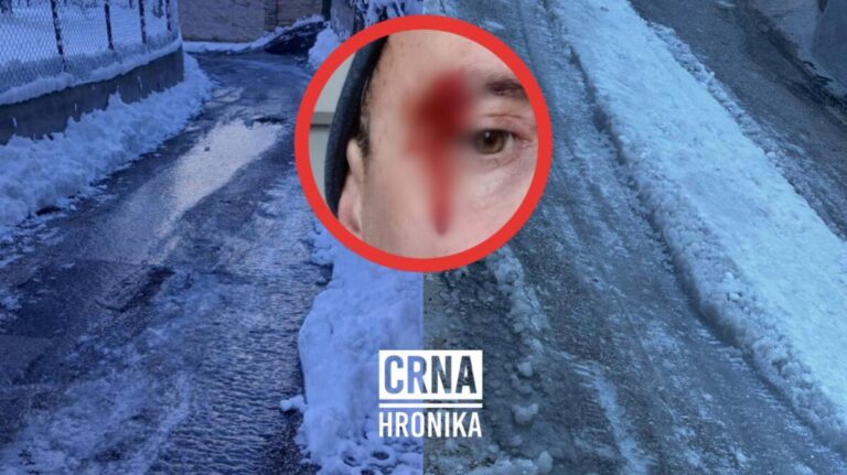 Sarajevo zaleđeno: “Otac pao i razrezao glavu, trudnica ne može do ljekara”