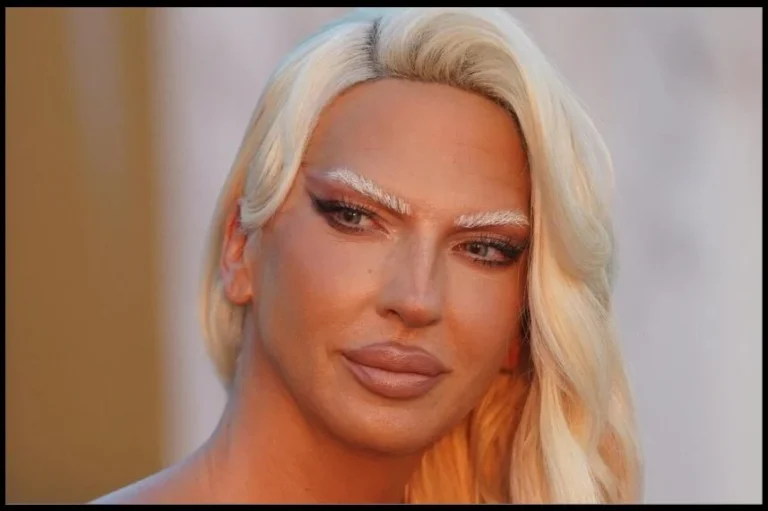 Karleuša bez dlake na jeziku: Žestok udar na kolegice zbog prirodnog krzna