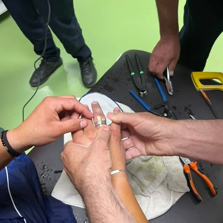 Neobična intervencija vatrogasaca u bh. gradu, skidali prsten s ruke