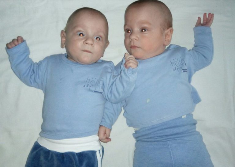 Bebice Ammar i Davud i dalje se bore za svoj život i trebaju pomoć svih nas