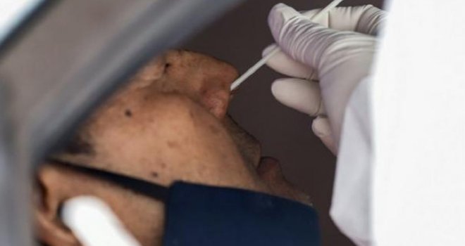 5f42835a 1718 46f1 9296 0b110a0a0a78 koronavirus culo mirisa njuh bris preview