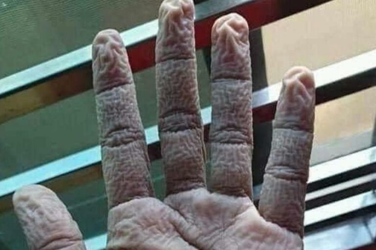 Goran Čerkez fotografijom ruke medicinske sestre poslao snažnu poruku građanima