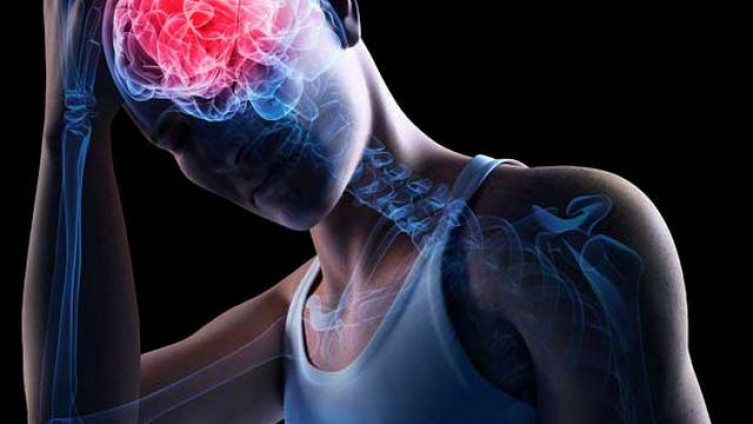 Šta jesti nakon moždanog udara