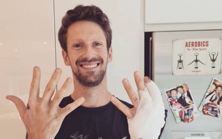 Doživio stravičnu nesreću: Pilot Formule 1 pokazao izgorjele šake