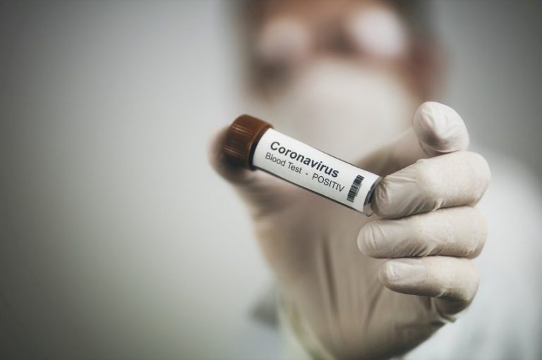 Potvrđen novi slučaj zaraze koronavirusom u BiH kod pacijenta iz Tešnja