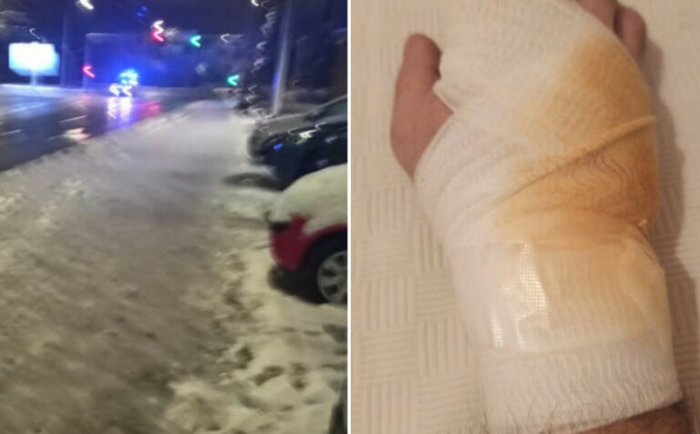 Drama u BiH: Migranti skalpelom isjekli Sarajliju