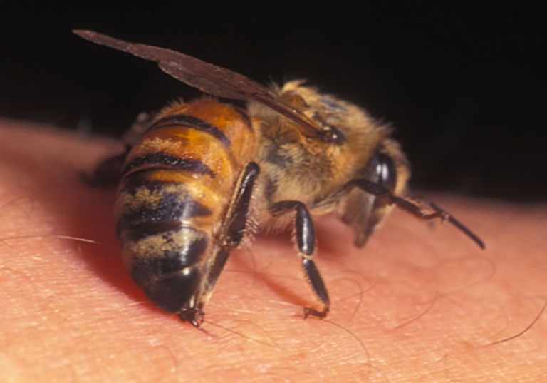 Ovaj genijalni trik kod uboda pčele ili ose svako treba da zna