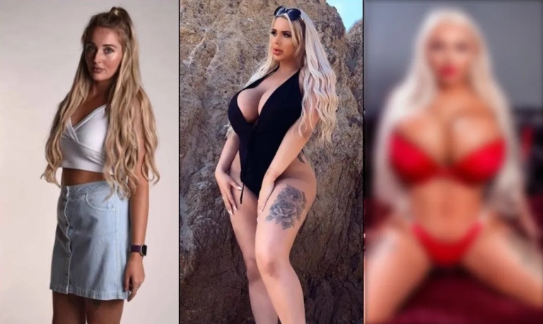 Potrošila oko 43 hiljade eura na plastične operacije, a tek su joj 22 godine