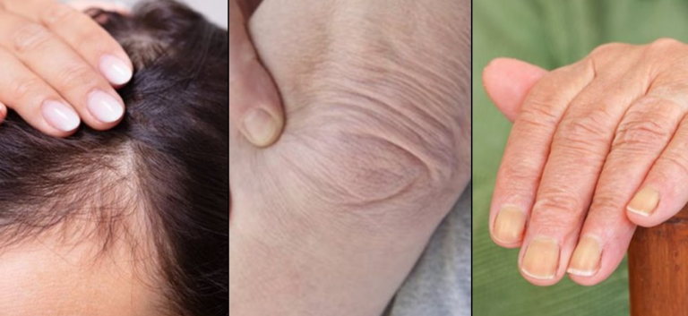 Dijelovi tijela koji osim lica mogu ‘odati’ vaše godine starosti