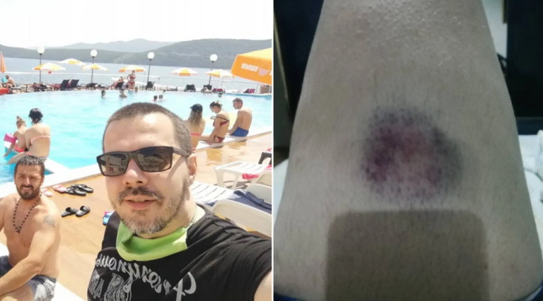 Crnogorski pjevač tvrdi: Policija u Neumu me tukla zbog pjesme