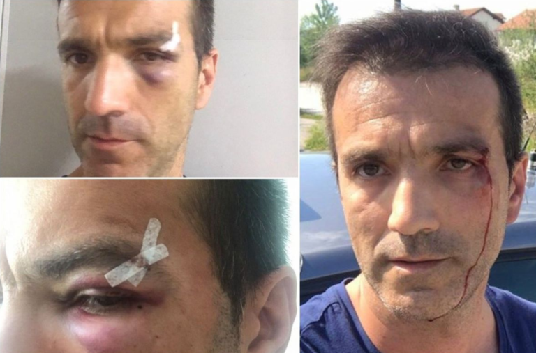 Incident u Sarajevu: Žalio se zbog loše usluge, pa završio u modricama