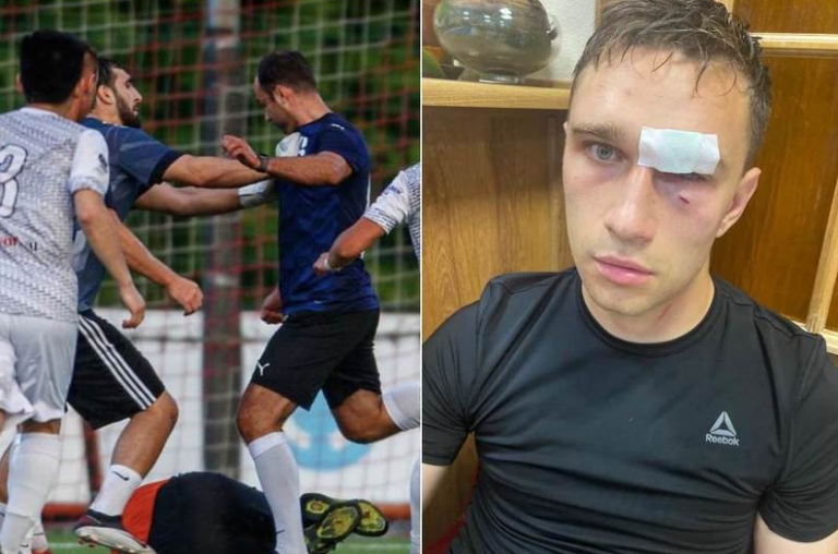 Najveći alkoholičar modernog nogometa i bivši kapiten Rusije brutalno pretukao sudiju