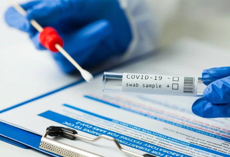 BiH nema na listi zemalja čije PCR testove priznaje Njemačka