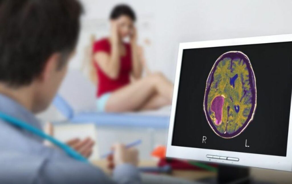 Tumor Mozak Ilustracija Foto Twitter