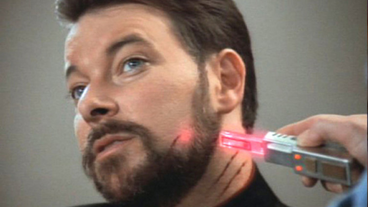 Lasersko šivenje rana “zlatnim nitima”