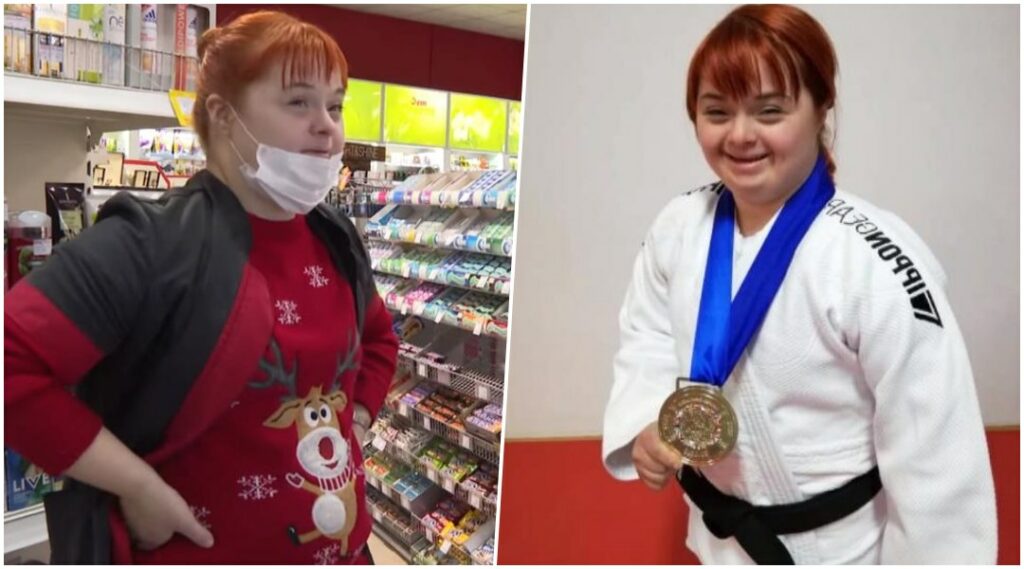 azra dedic downov sindrom 2