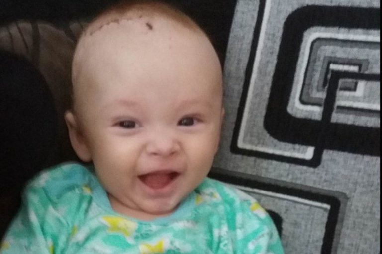 POZITIVNE VIJESTI Šestomjesečni Arslan operisan u Turskoj, njegovo stanje trenutno je stabilno