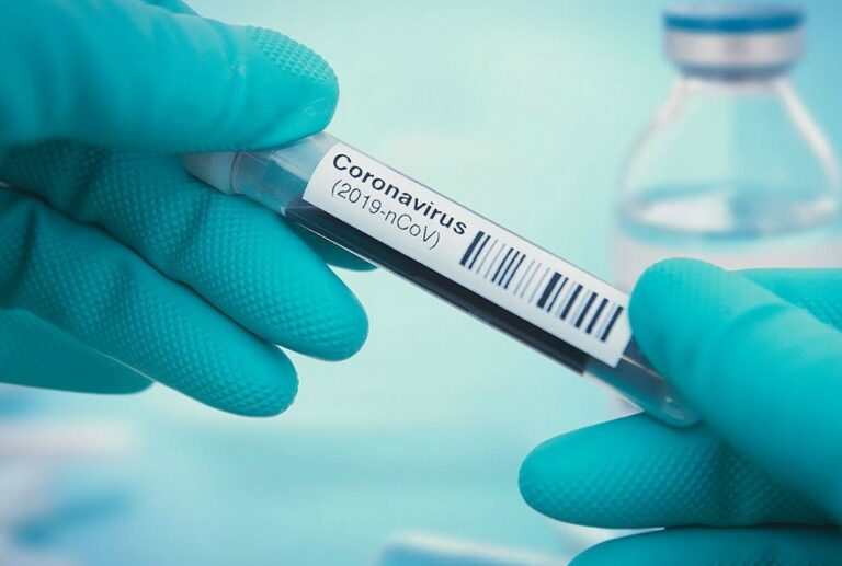 Plašite se Corona virusa? Ove zdrave navike poboljšat će vaše zdravlje