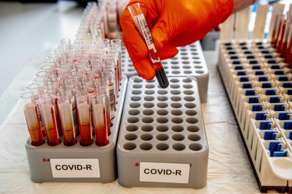 covid test koronavirus 1536x1023 1