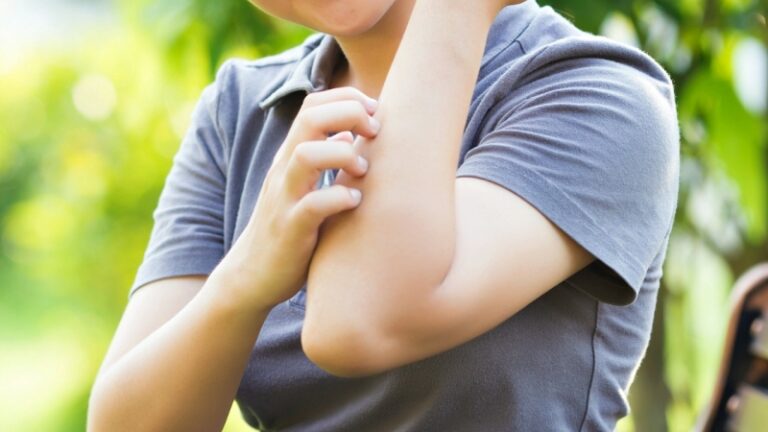 Kako spriječiti ubod komarca: Uz ova dva sastojka iz kuhinje više vam neće prići