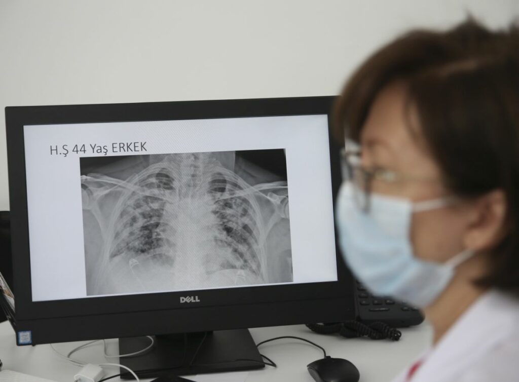 doktor turska doktorica snimak pluca nalazi covid AA03