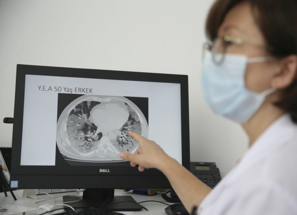 doktor turska doktorica snimak pluca nalazi covid AA08 1