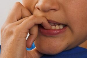 grickanje 11 696x464 1