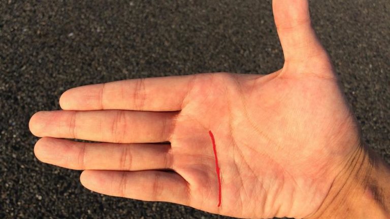 Samo dva posto ljudi na svijetu ima ovu liniju na dlanu