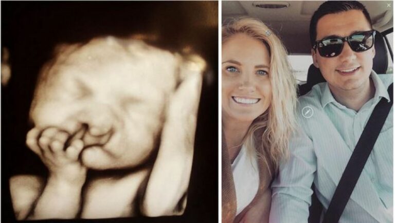 Ljekari tražili od majke da abortira zbog deformiteta bebe: Nije ih poslušala