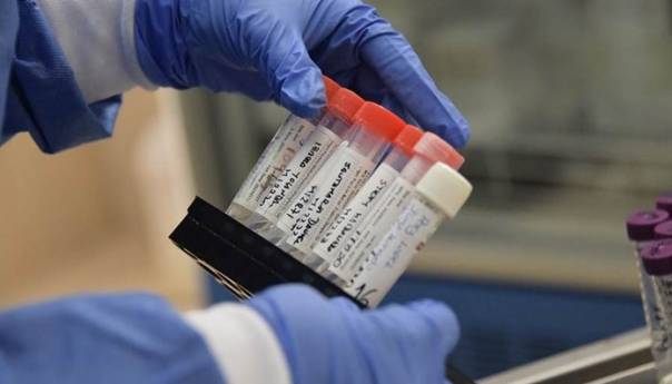 njemacka nabavila nove antigen testove na covid za staracke domove testovi koronaaa 5fa1b04d3272b