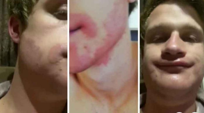 obojio bradu 1 696x385 1